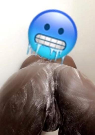  Sugar